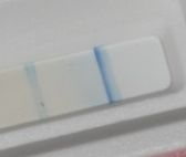 PerioMarker, der neue Schnelltest.