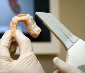 Digitaler Zahnabdruck mit dem 3D-Scanner